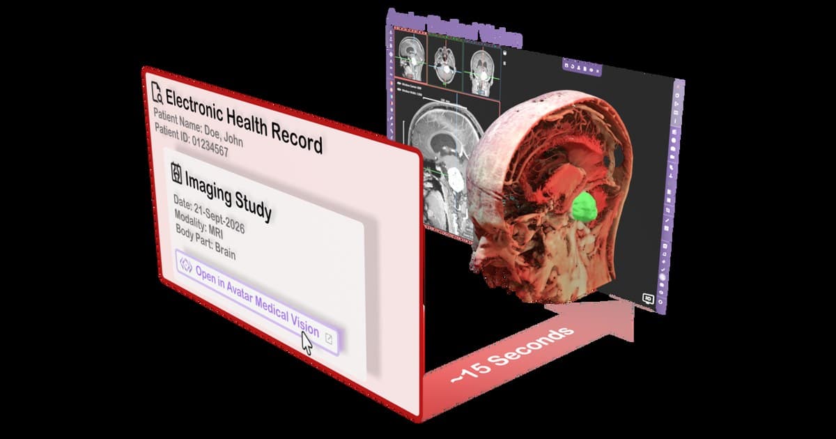 Avatar Medical Integrates with Epic to Bring Patient-Specific 3D Anatomy to the Clinic Faster